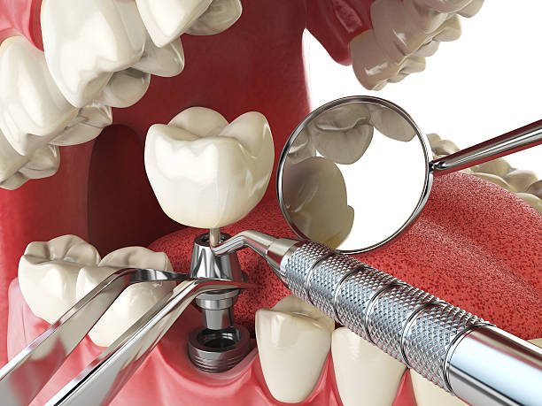 Best Weekend Emergency Dentist in Paoli, IN
